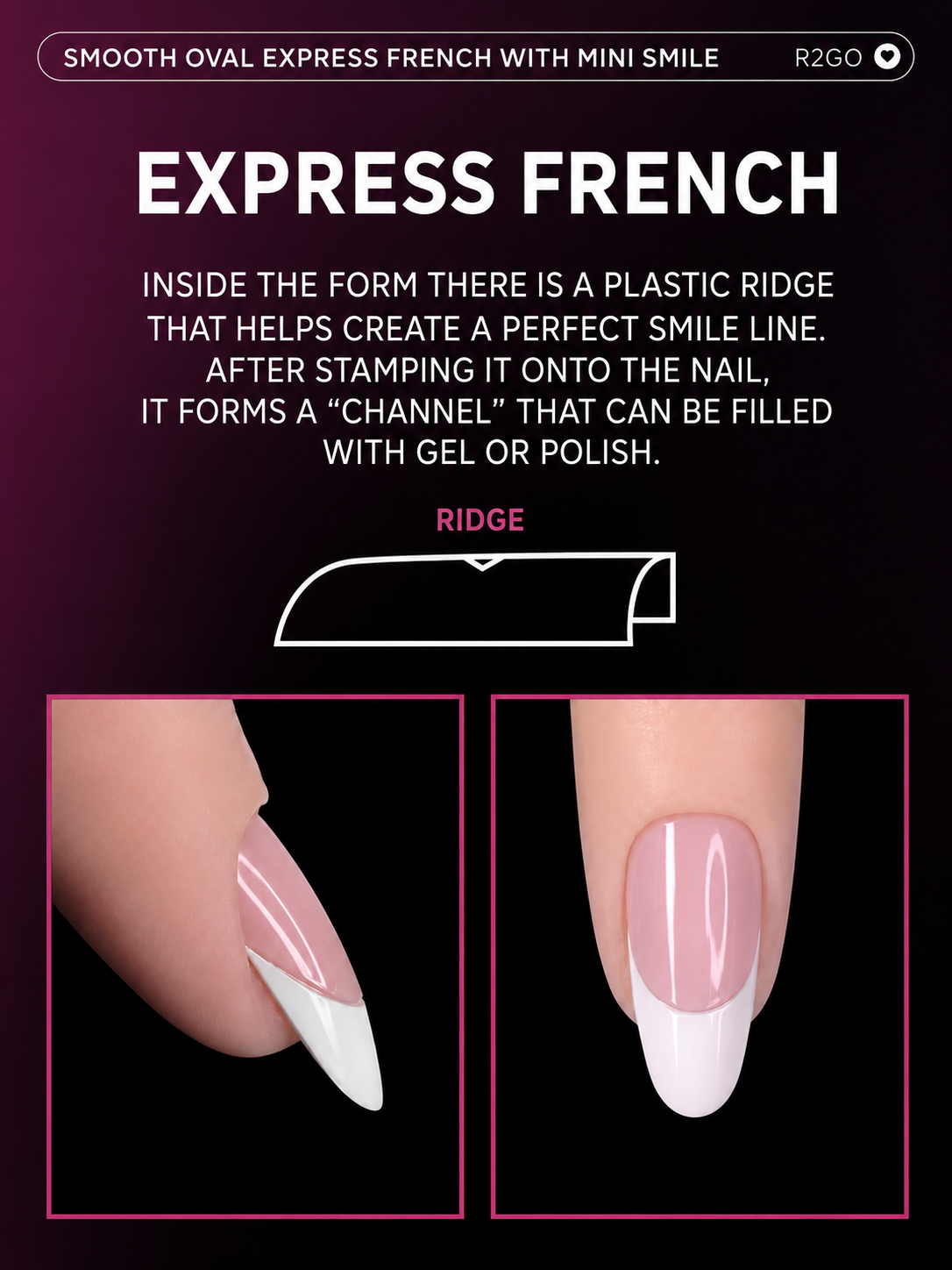 Dual Forms Ready2GO" by Maris.Kid - Smooth Oval Express French Mini Smile Upper Forms
