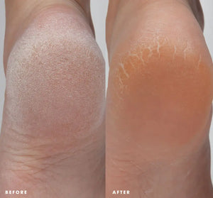 Farmhouse Fresh- Enrich Mint Foot Rescue Mask